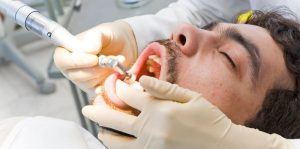 Oral Sedation Oral Sedation