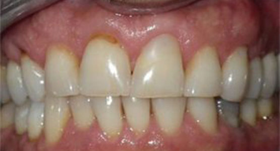 Houston Precise Dental Care