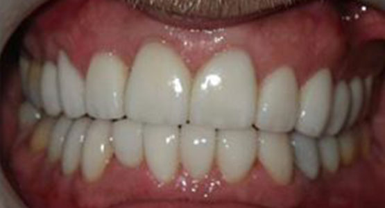 Houston Precise Dental Care