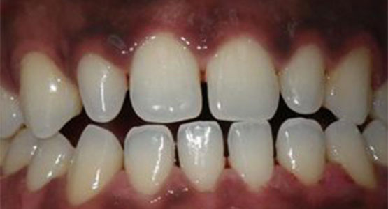 Houston Precise Dental Care