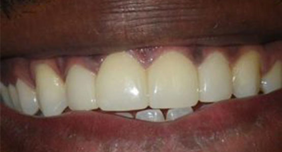 Houston Precise Dental Care